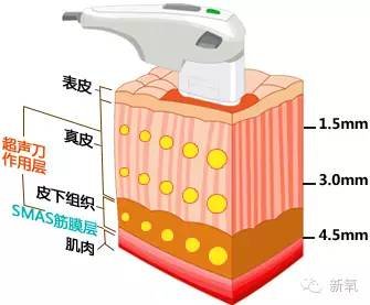 案例图片