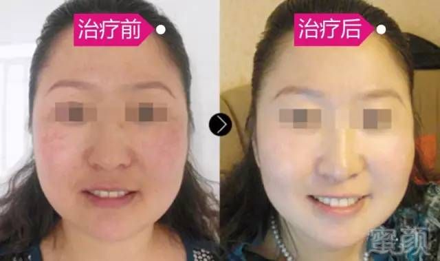 https://img.miyanlife.com/timg/161009/15254Wb9-16.jpg