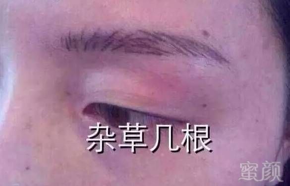 案例图片