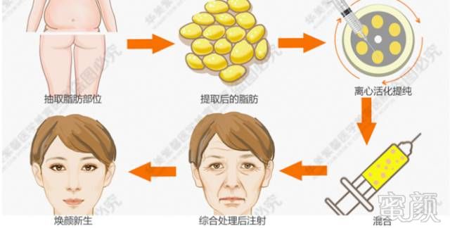 https://img.miyanlife.com/timg/161025/13415615T-9.jpg