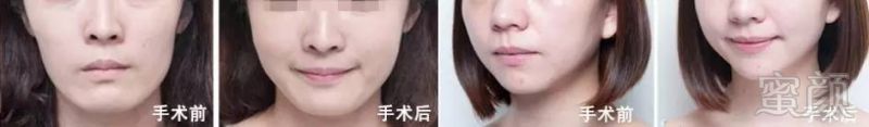 https://img.miyanlife.com/timg/161025/1I3505P9-3.jpg