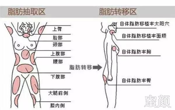 https://img.miyanlife.com/timg/161027/14144TL5-8.jpg