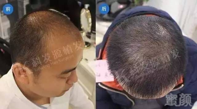 https://img.miyanlife.com/timg/161206/15000MT6-6.jpg