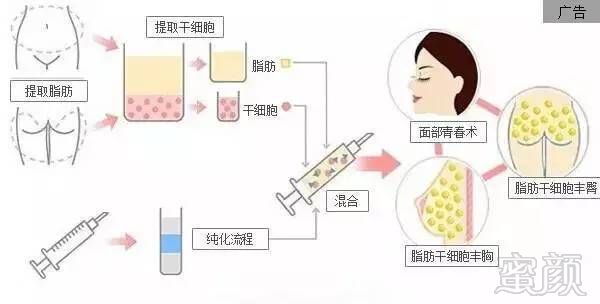https://img.miyanlife.com/timg/161209/1355454418-4.jpg