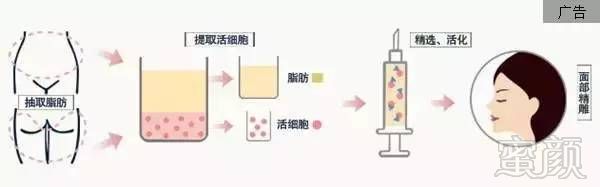 https://img.miyanlife.com/timg/161209/1355455957-5.jpg