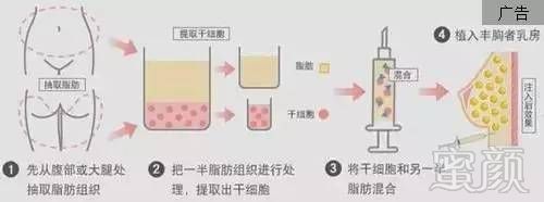 https://img.miyanlife.com/timg/161209/135545L41-3.jpg