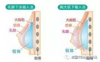 案例图片