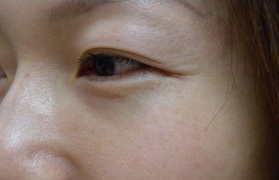 今天拍的 鱼尾纹不是那么明显了.                 去鱼尾纹