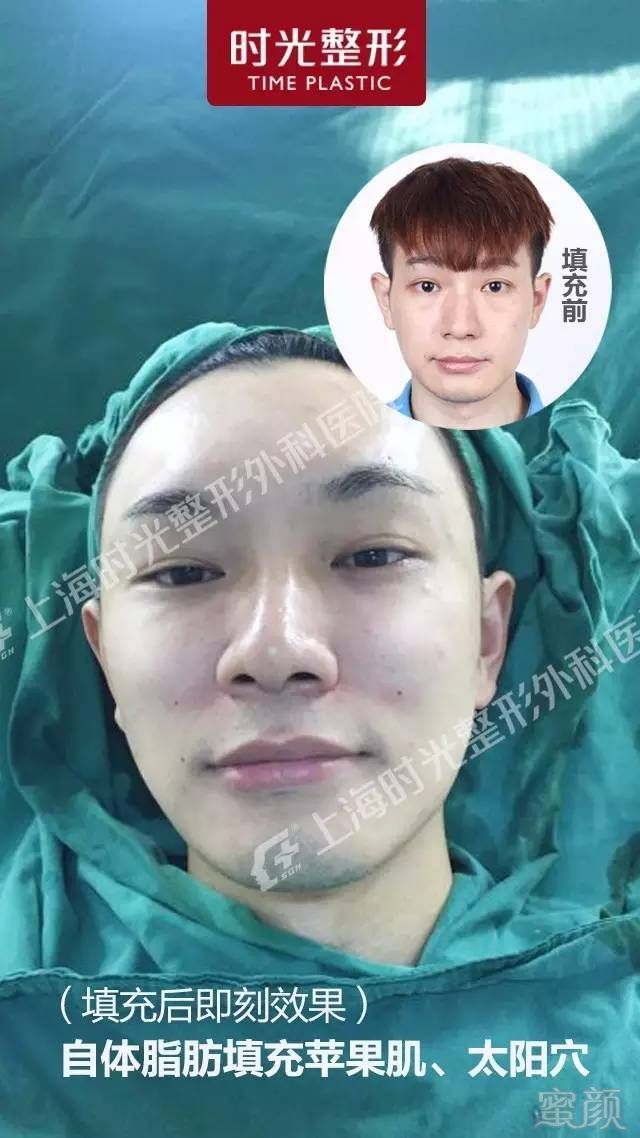 https://img.miyanlife.com/timg/161211/16215920F-6.jpg