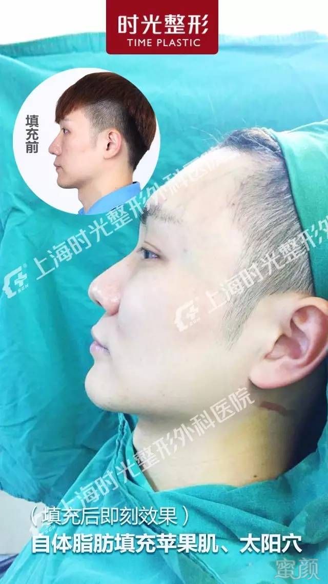 https://img.miyanlife.com/timg/161211/1622001021-7.jpg