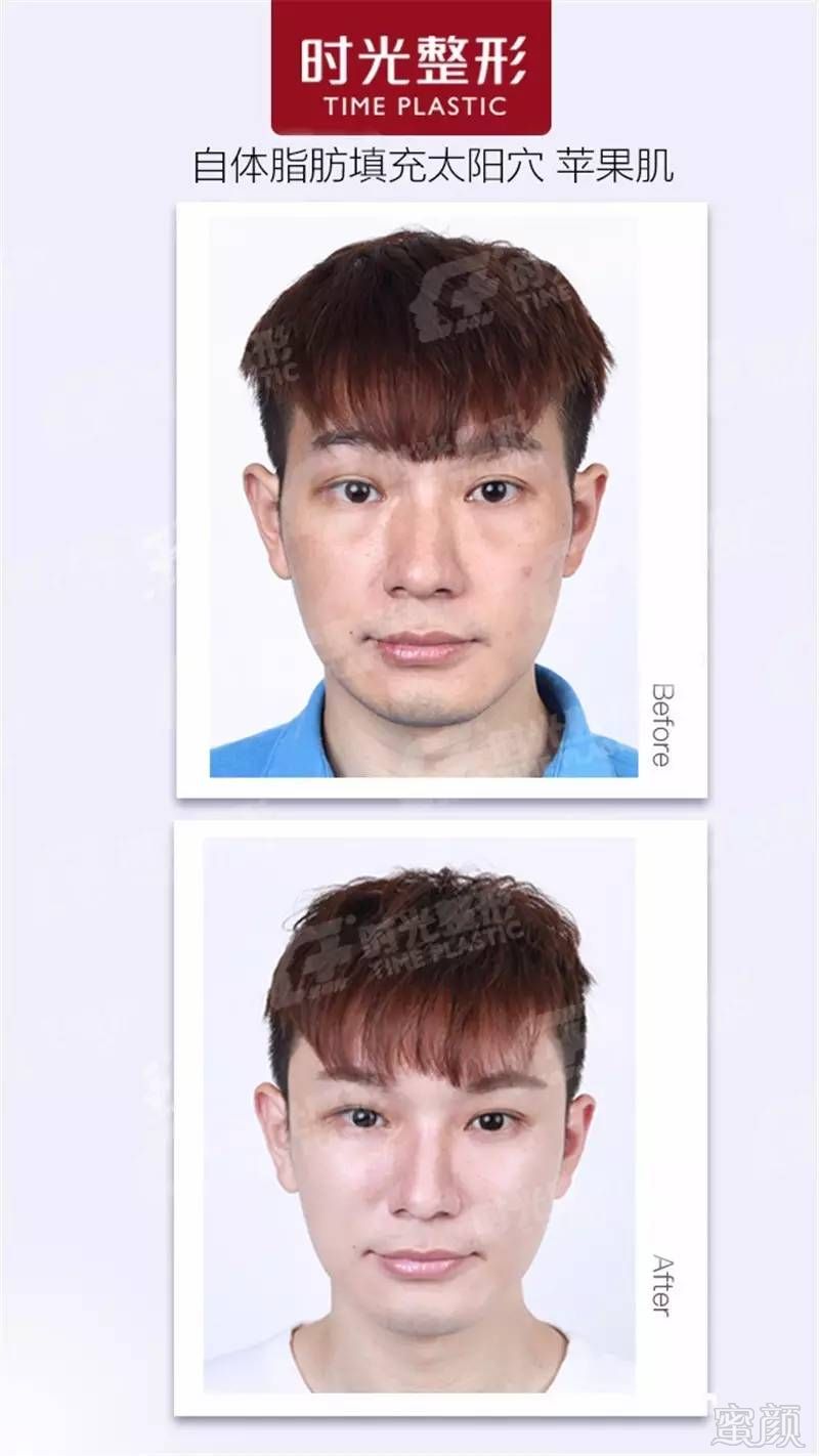 https://img.miyanlife.com/timg/161211/1622003K7-8.jpg