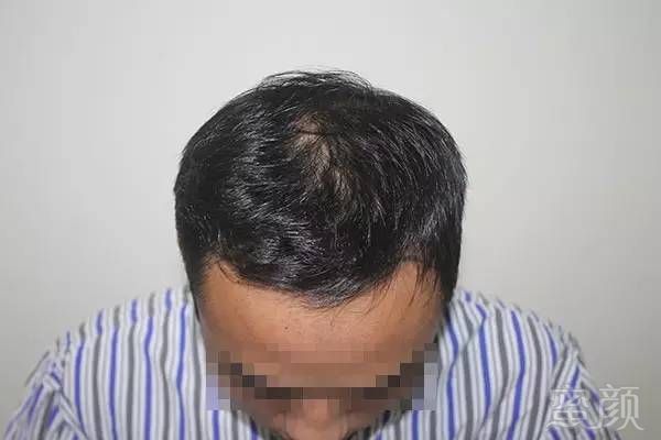 https://img.miyanlife.com/timg/161212/1221115929-1.jpg