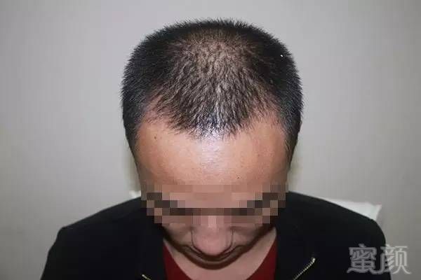 https://img.miyanlife.com/timg/161212/122115Ca-11.jpg