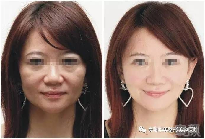 https://img.miyanlife.com/timg/161218/222KJ0H-5.jpg