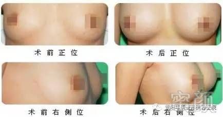 https://img.miyanlife.com/timg/161218/222KW957-8.jpg