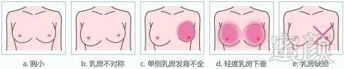 https://img.miyanlife.com/timg/161224/15521QO6-4.jpg