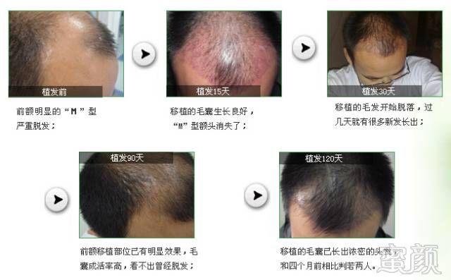 https://img.miyanlife.com/timg/161224/155PM161-4.jpg