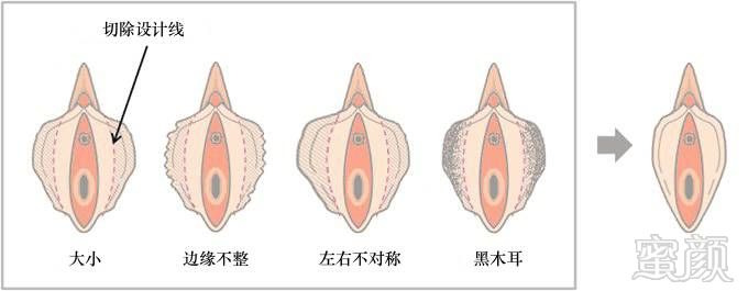 案例图片