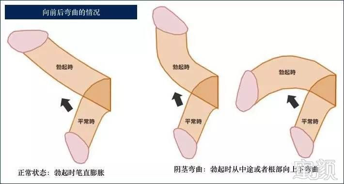 案例图片