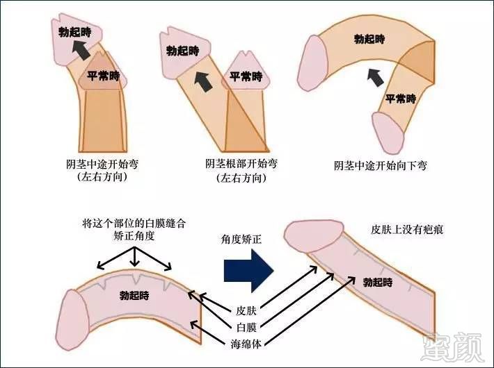 案例图片