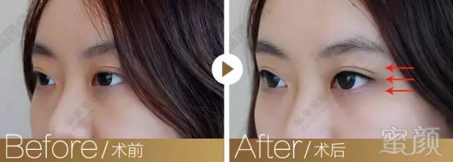 https://img.miyanlife.com/timg/170114/1309192405-6.jpg