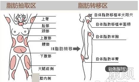 https://img.miyanlife.com/timg/170122/2354035538-18.jpg