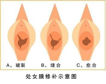 案例图片