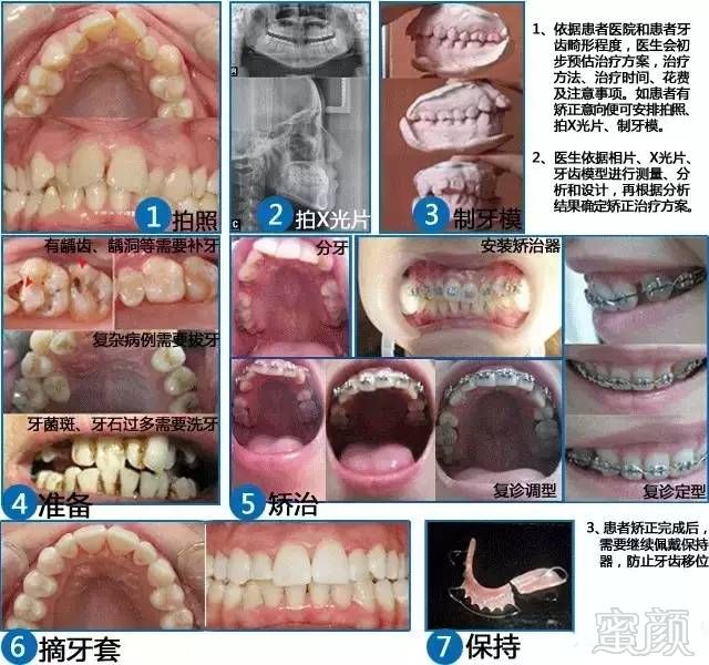 https://img.miyanlife.com/timg/170222/2213113441-7.jpg