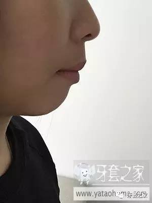 https://img.miyanlife.com/timg/170222/2229235643-2.jpg