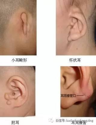 https://img.miyanlife.com/timg/170303/2322062926-1.jpg