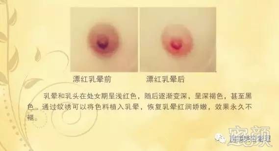 https://img.miyanlife.com/timg/170303/2324302061-1.jpg