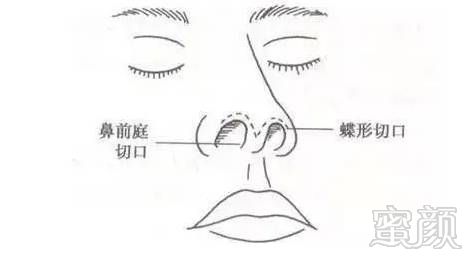 鼻颌缝具体位置图片