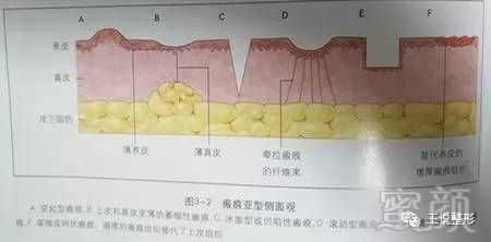 https://img.miyanlife.com/timg/170323/00150R126-5.jpg