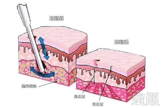 案例图片