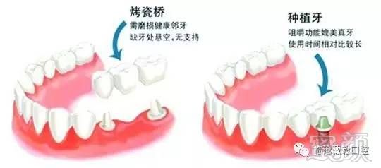 案例图片