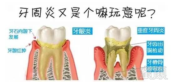 https://img.miyanlife.com/timg/170405/2232435Z6-6.jpg