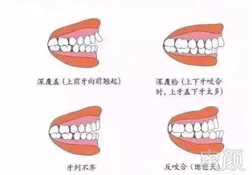 https://img.miyanlife.com/timg/170406/0000322230-4.jpg
