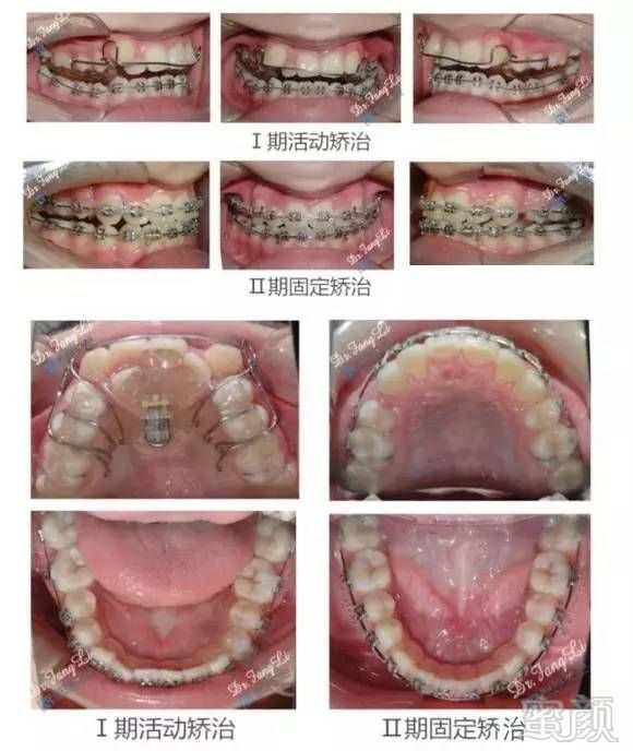 https://img.miyanlife.com/timg/170406/000032NX-5.jpg