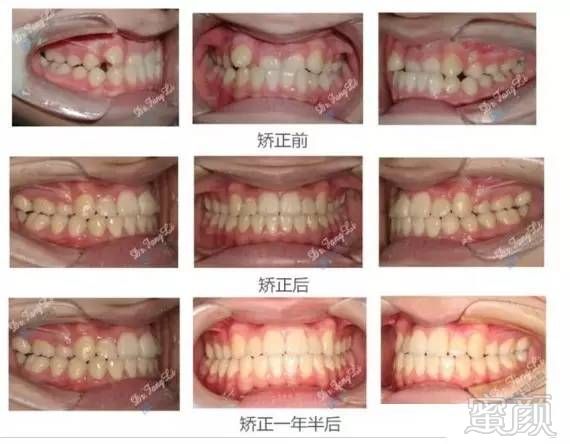 https://img.miyanlife.com/timg/170406/0000331264-6.jpg
