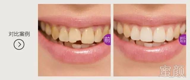 https://img.miyanlife.com/timg/170406/0000336008-8.jpg