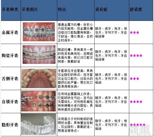 https://img.miyanlife.com/timg/170406/1641354115-4.jpg