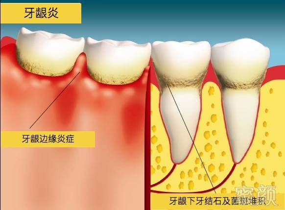 https://img.miyanlife.com/timg/170406/1AIK152-1.jpg