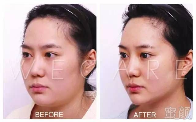 https://img.miyanlife.com/timg/170407/0016093332-13.jpg