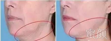 https://img.miyanlife.com/timg/170407/0016093352-11.jpg