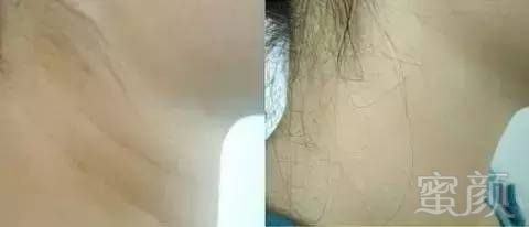 https://img.miyanlife.com/timg/170407/0016096346-10.jpg