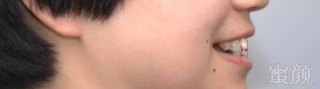 https://img.miyanlife.com/timg/170407/222RH3H-13.jpg