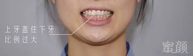 https://img.miyanlife.com/timg/170407/222RK543-15.jpg