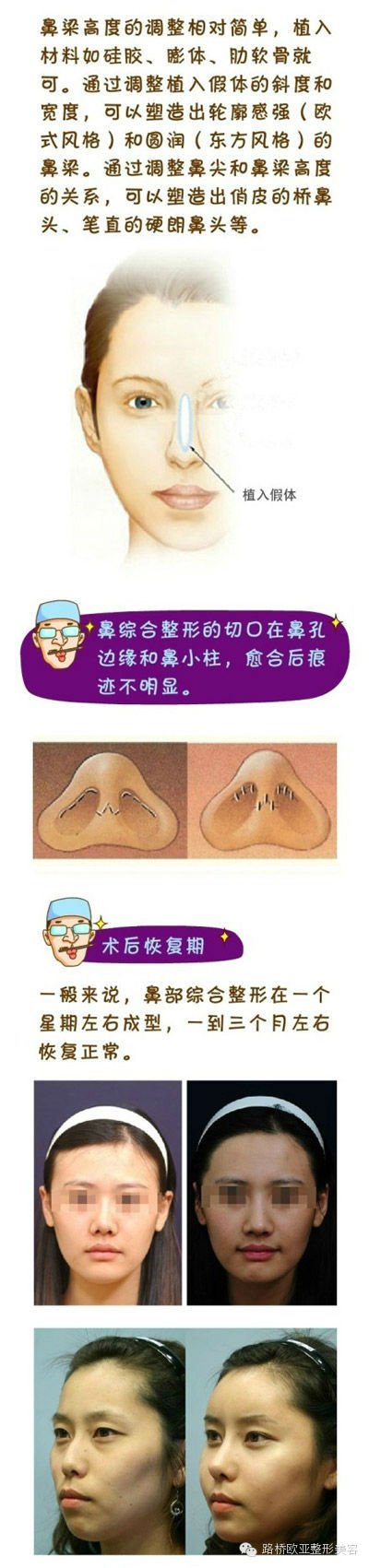 https://img.miyanlife.com/timg/170407/225ZR434-2.jpg