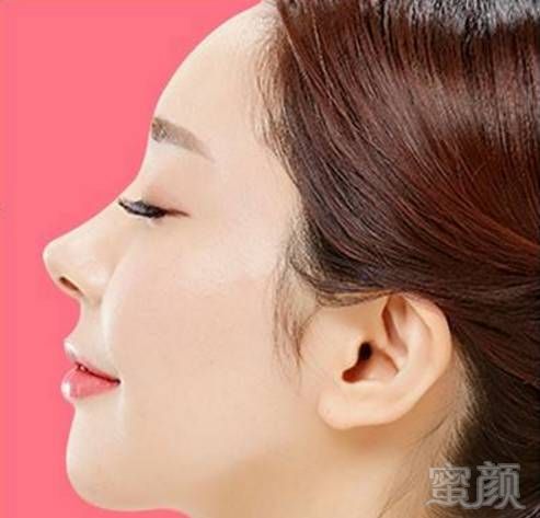 https://img.miyanlife.com/timg/170413/205422E37-0.jpg