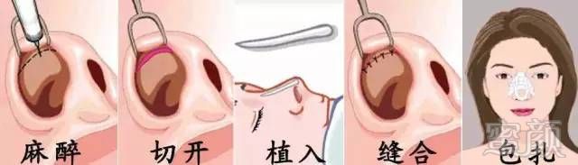 https://img.miyanlife.com/timg/170413/2054305019-12.jpg